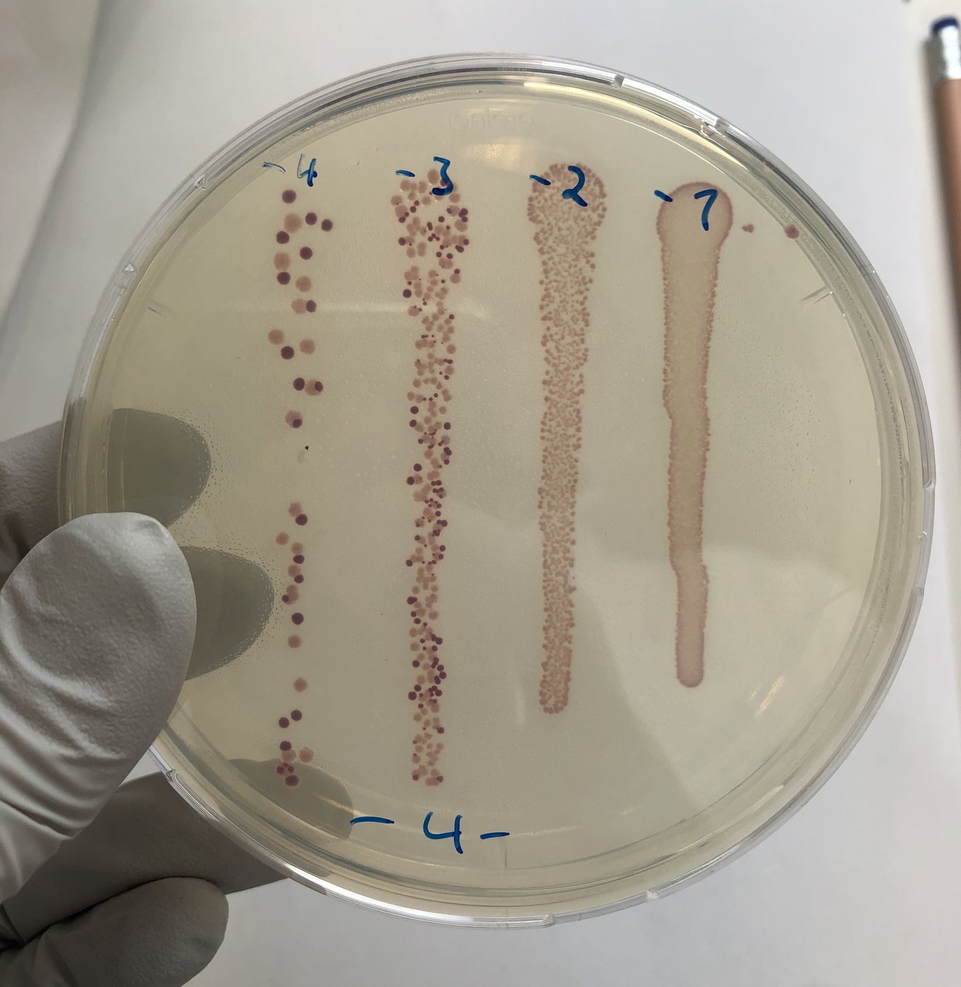Bacterial colonies streaked on an agar plate